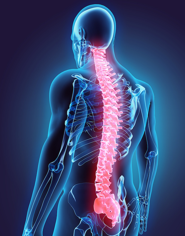 Spinal Cord Stimulation for Pain: Am I a Candidate?