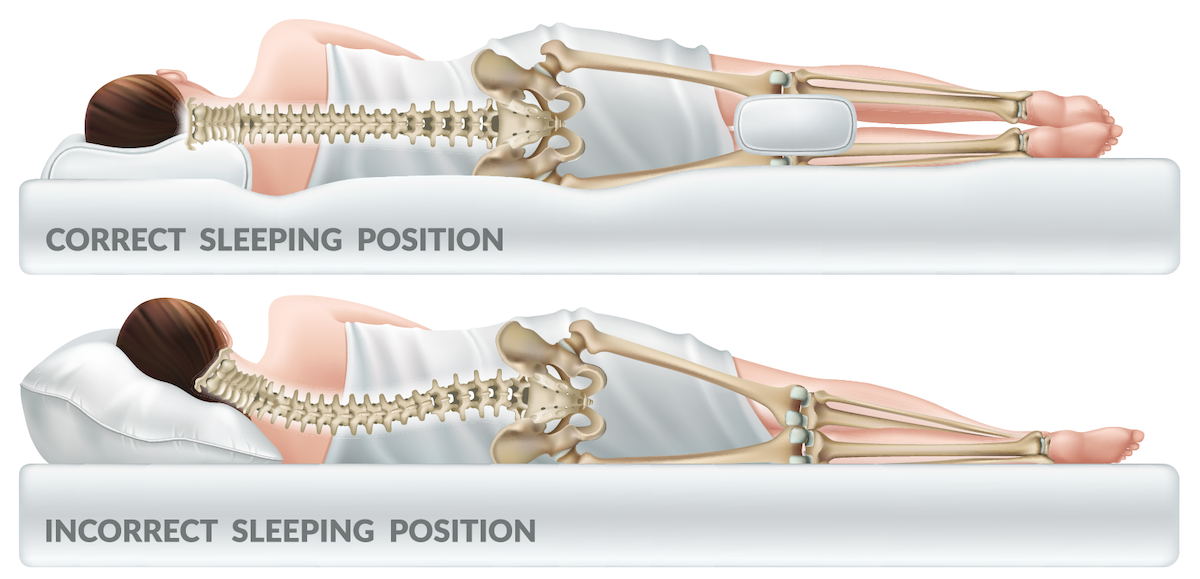 https://www.shantispinesurgery.com/wp-content/uploads/2020/02/Shanti-Spine_Sleep-Positions-for-Back-Pain.png